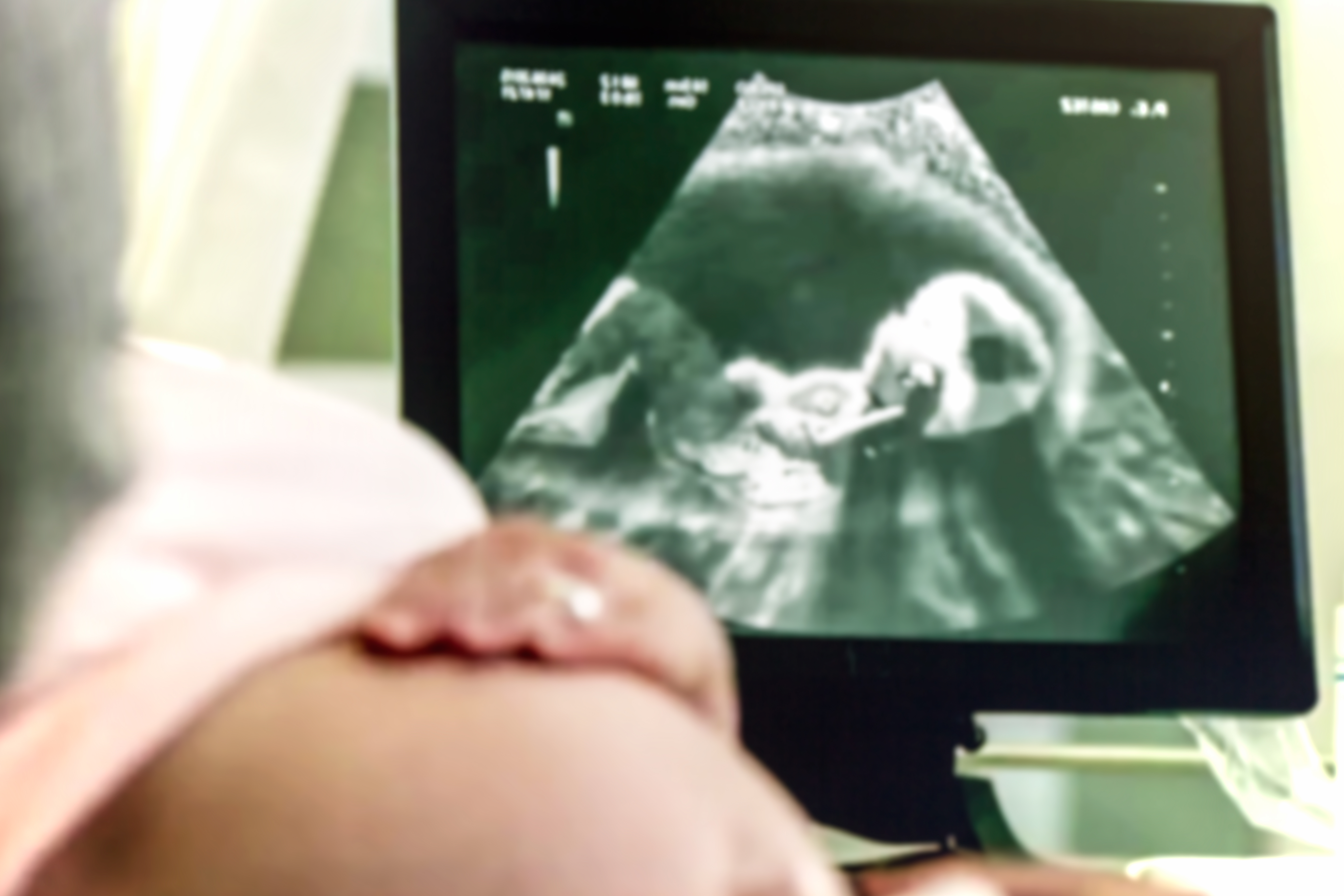 Pregnancy Ultrasound 4D Tampa