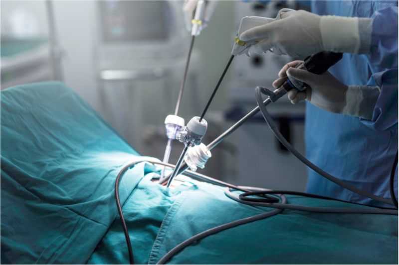 OBGYN Minimally Invasive Laparoscopic Surgeon Tampa